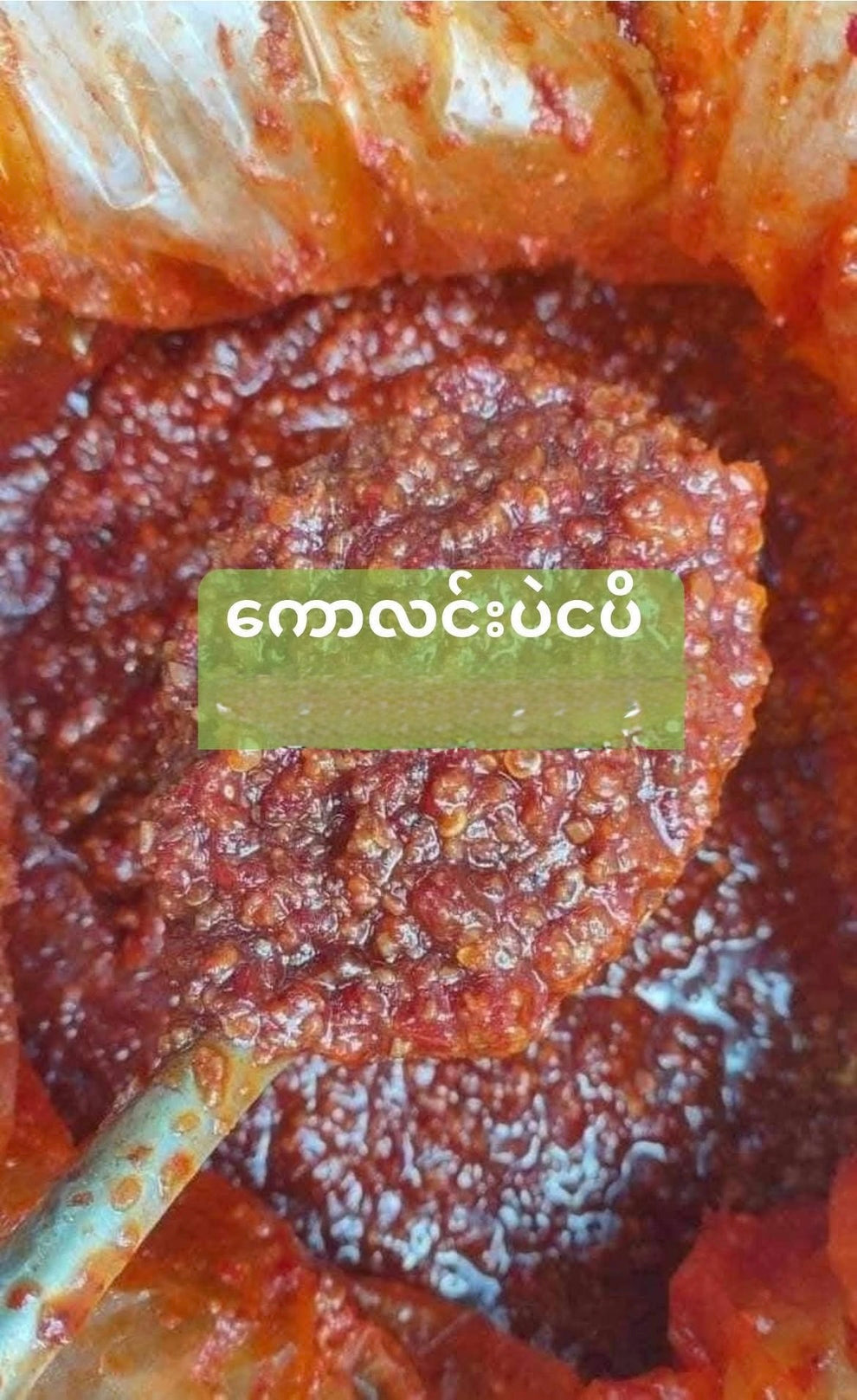 ဒို့တောရွာ ကောလင်း ပဲငပိအနှစ်